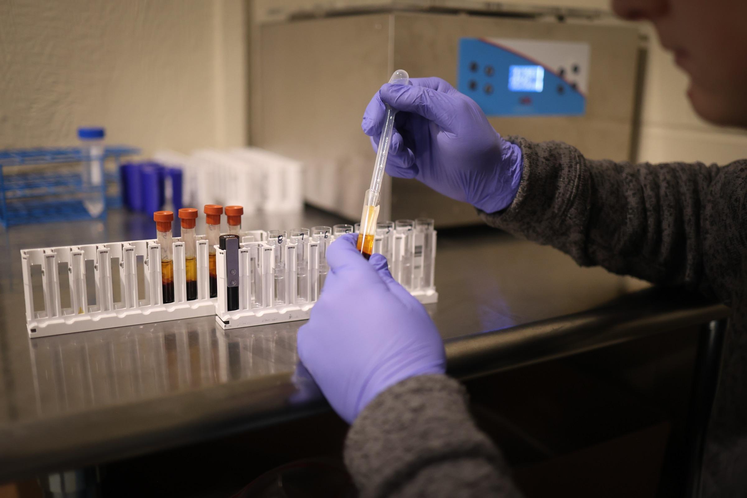 A technician running samples at the bench in the Solo Select Diagnostics lab